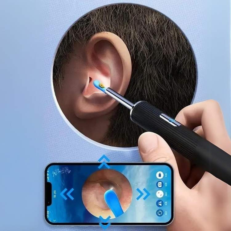 EarScope Pro Wax Removal Kit - Ear Wax Removal Kit - Wild Eye Vision